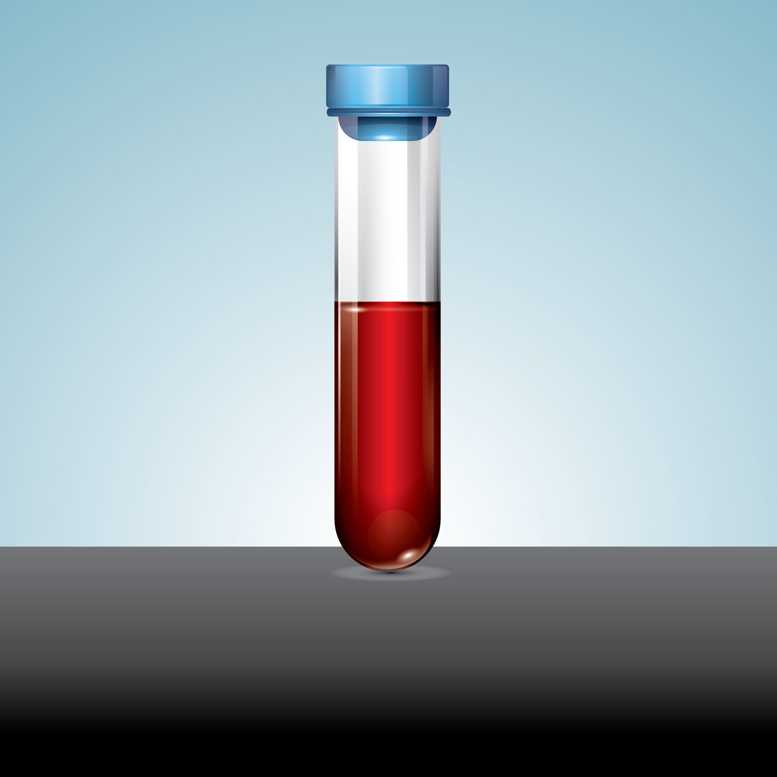 blood-profiles-to-be-offered-at-jch-l-jc-health-and-life